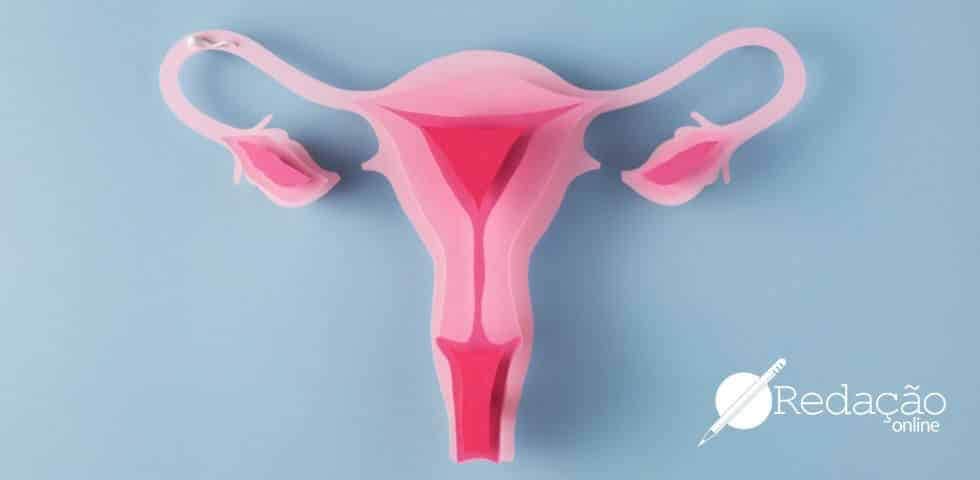 endometriose-anitta-doença