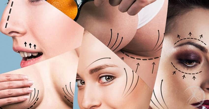 várias cirurgias plásticas